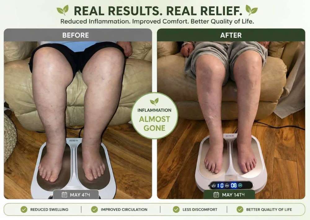 Before-and-after comparison showing reduced swelling in a person's legs and feet over a 10-day period following use of the OlyLife TERA P90 Plus.