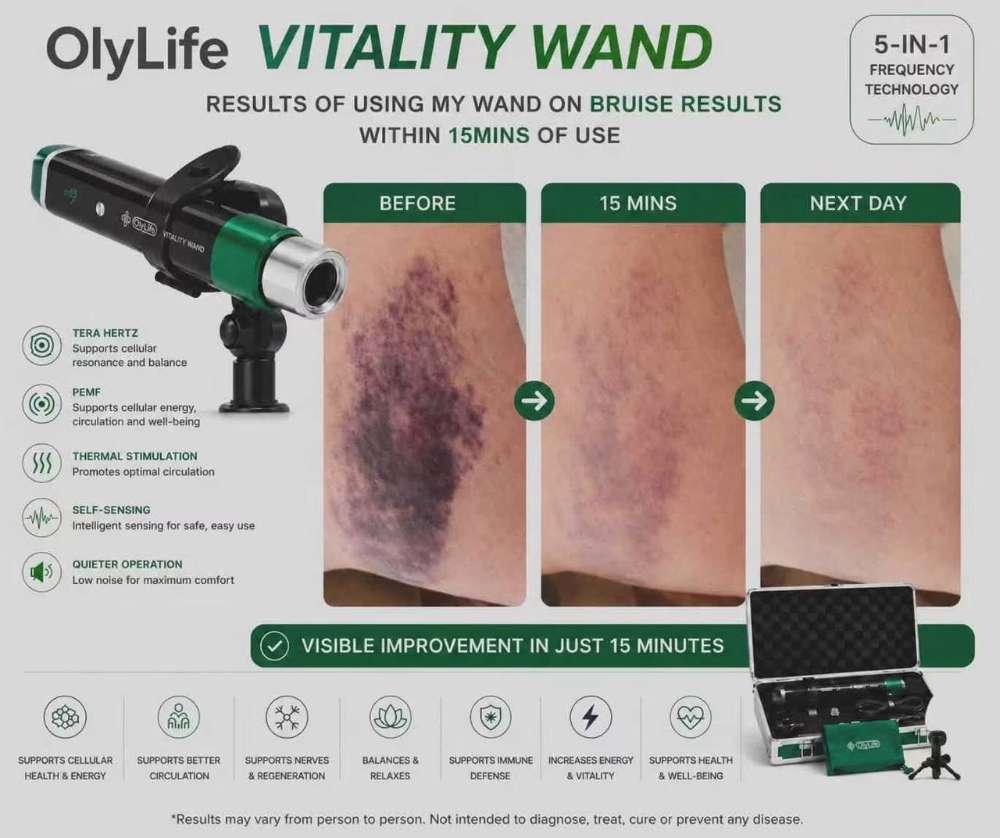 Before, 15-minute, and next-day comparison showing the appearance of a bruise following use of the OlyLife Vitality Wand.